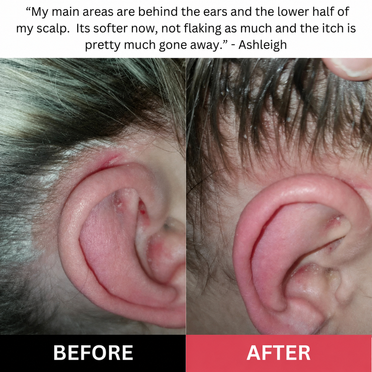 Restore Scalp Scrub