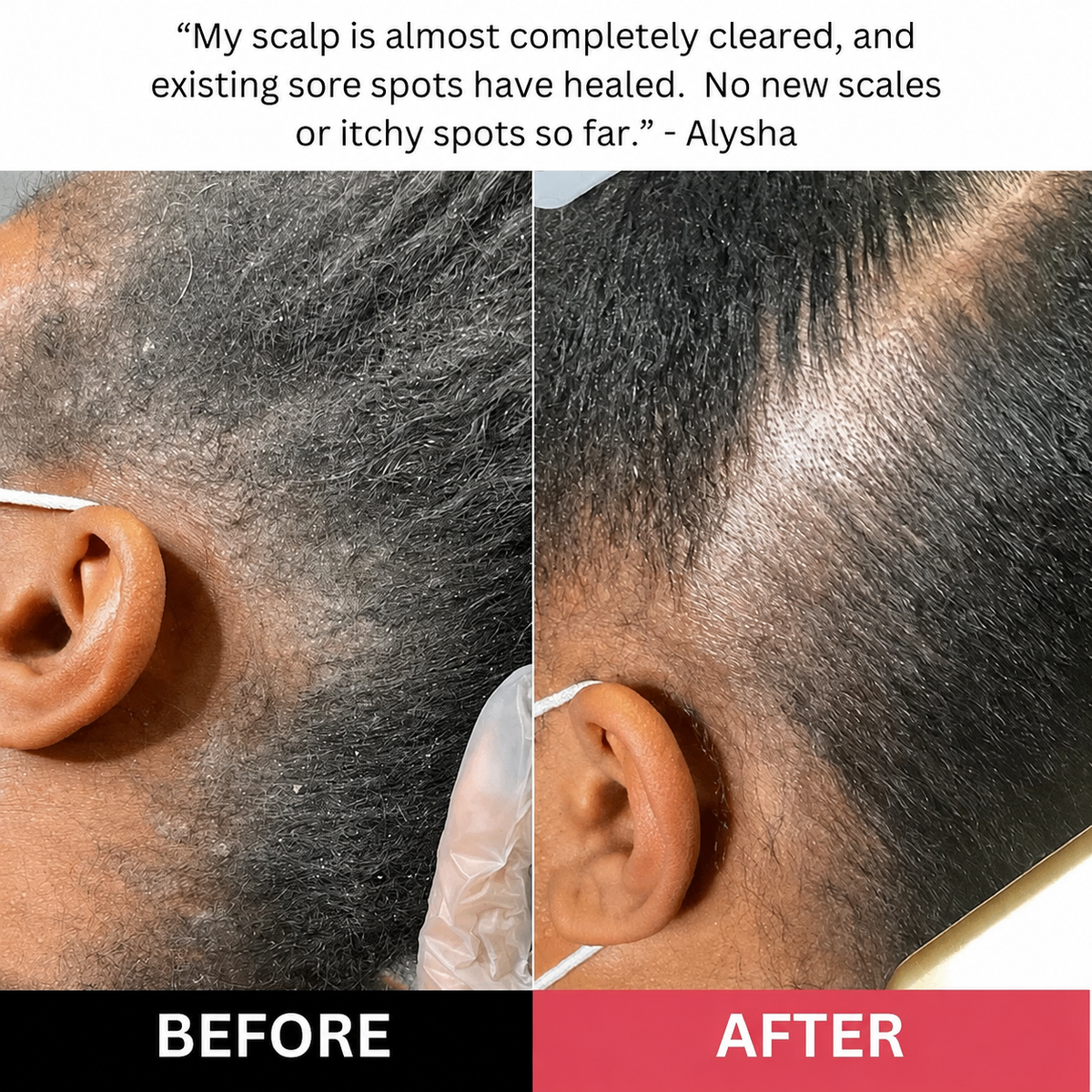 Restore Scalp Scrub